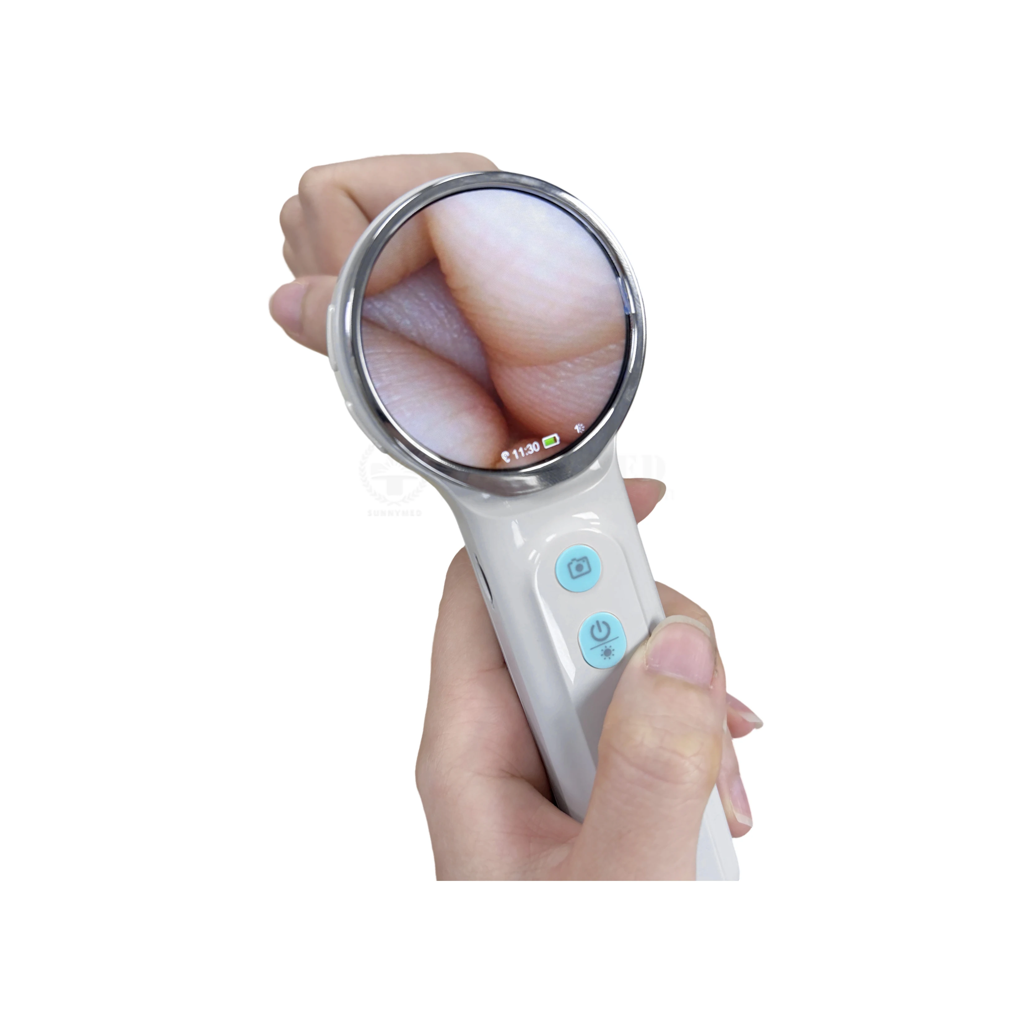 SY-G046-4 Clear Image Veterinary  Video Otoscope with Connect Computer Via USB Cable fast shipping