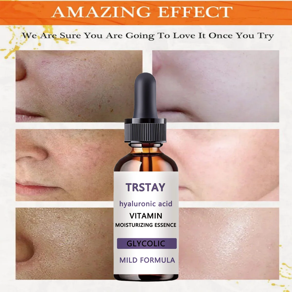 30% glycolic acid essence can fade spots, shrink pores, brighten skin tone and control oil