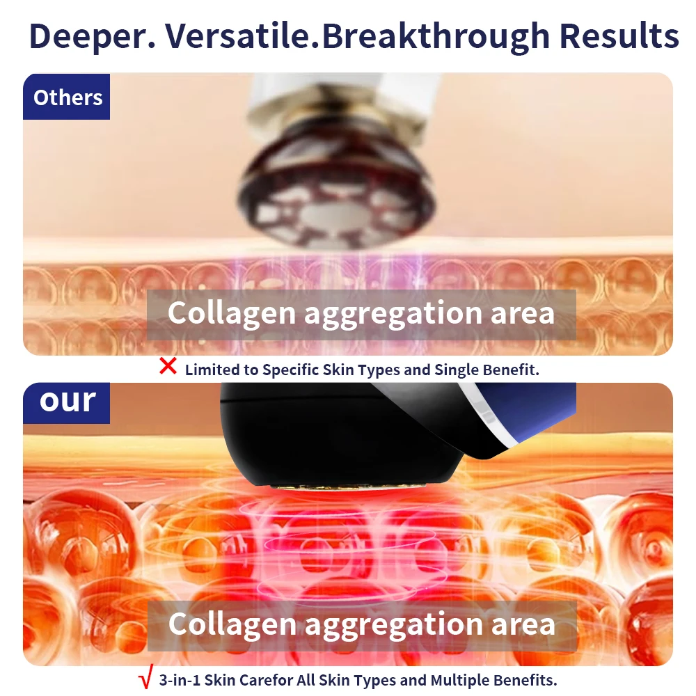 آلة شد الجلد مكركرنت RF EMS 3 في 1 جهاز مكافحة الشيخوخة الاهتزاز العلاج بالضوء الأحمر لرفع الوجه وإزالة التجاعيد #2