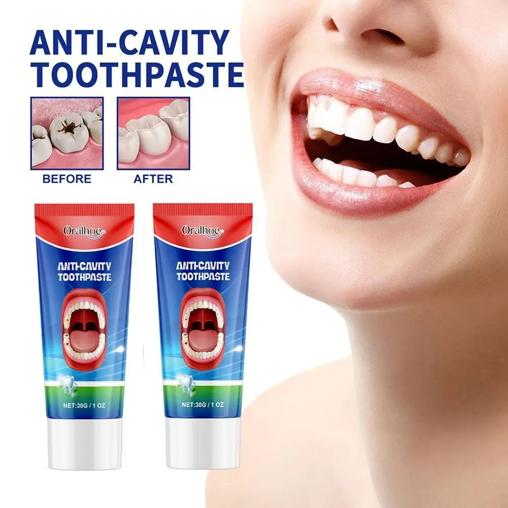 2PCS Anti Decay Toothpaste Dental Caries Repair Cream Decay Protect Teeth Remove Plaque Toothache Relieve Periodontitis