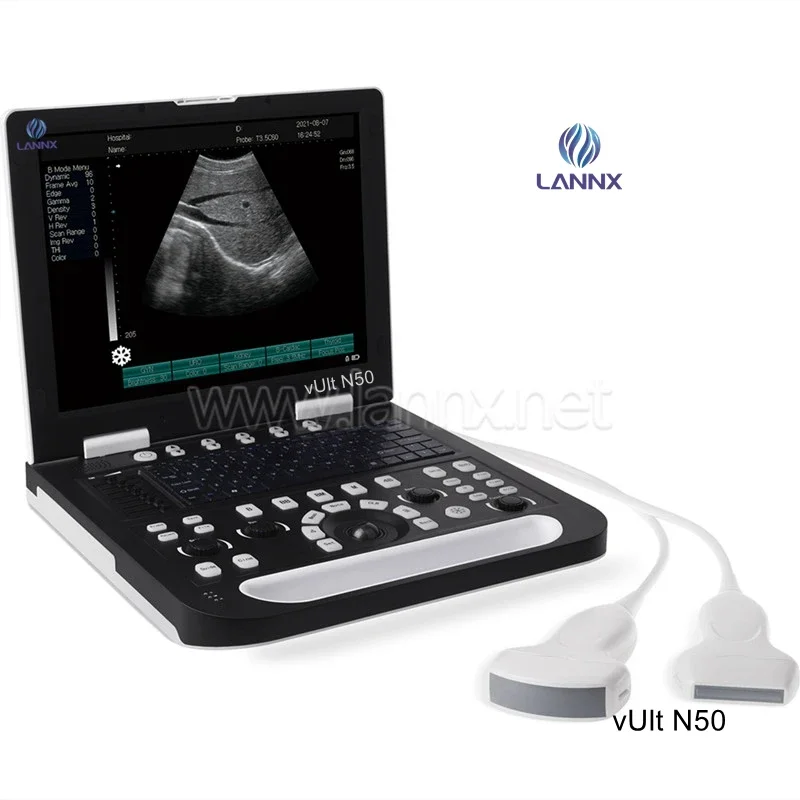 LANNX vUlt N50 Hot Sale portable animals ultrasound Scanner Machine For cow horse Animal Veterinary Ultrasound with prode