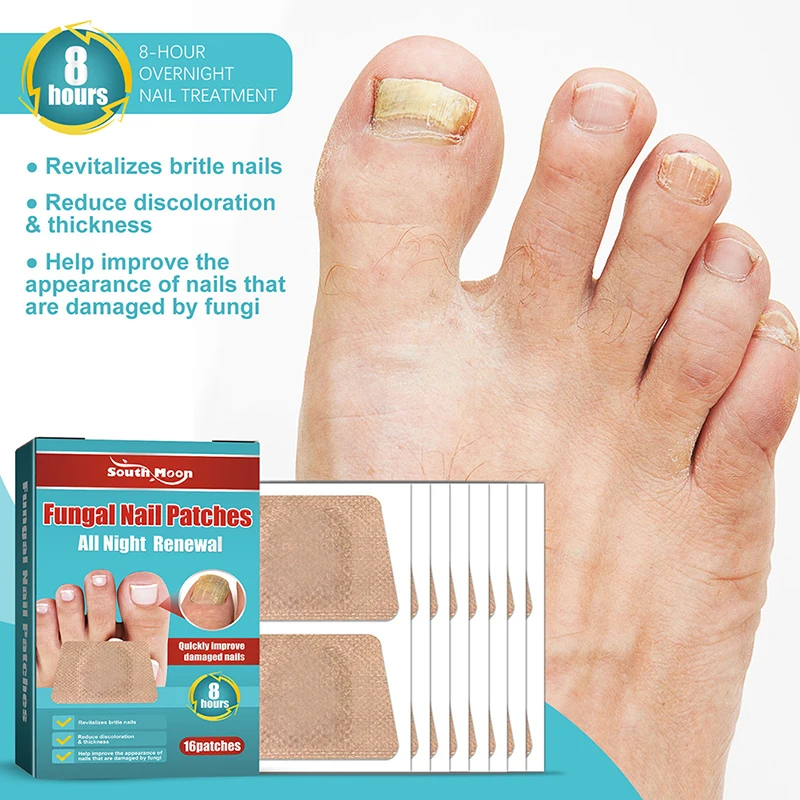 Unha Fungal Tratamento Patch, Anti Correção Fungosa Adesivos, Ingrown Toenail Care, Paroníquia Anti Infecção Reparação, 16Pcs