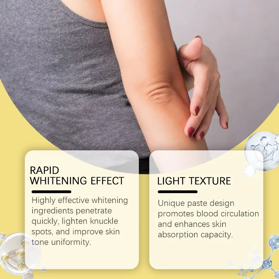 OUHOE crema para el cuidado de la piel de las articulaciones hidratante e hidratante piel de las articulaciones del cuerpo piel tierna y suave acantoderma hidratante de la piel