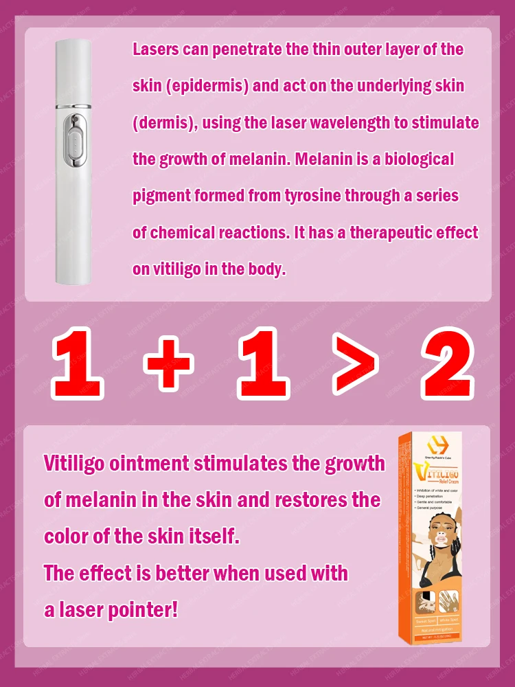 Efficient laser technology to quickly improve vitiligo - Image 4