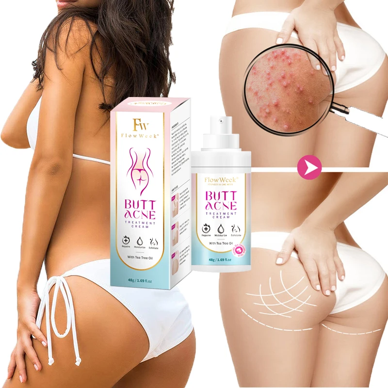 48g Butt Body Acne Whitening Cream Acne Clearing Spot Treatment Lotion Skin Care for Buttock Thigh Whiten Skin Body care