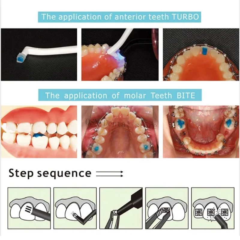5 مل/قطعة لاصق توربو للأسنان م - مراجعة Teeth Whitening With Blue Light وسعره