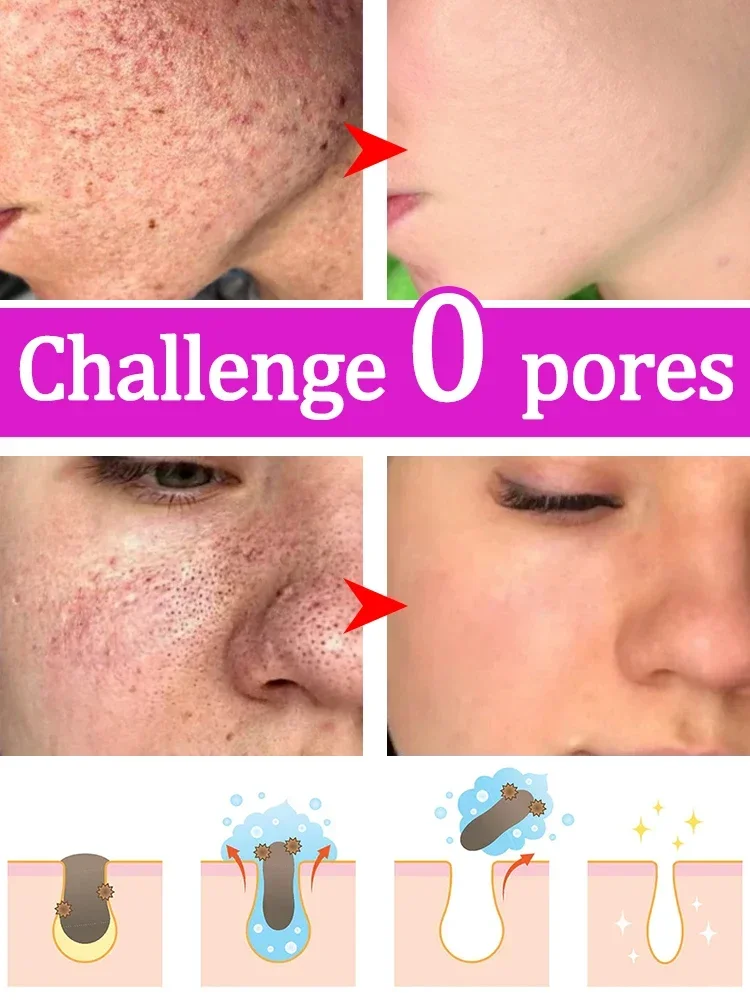 Pore Refining Serum Cleanses Pores