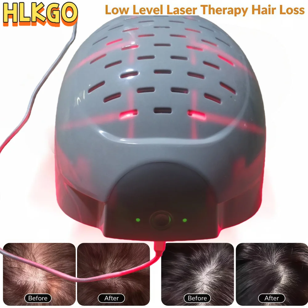 

6750mW 300 Diodes Hair Growth Cap, Anti Hair Loss Laser Helmet 650nm LLLT Device Stimulates Regrowth & Thickening Hair Care