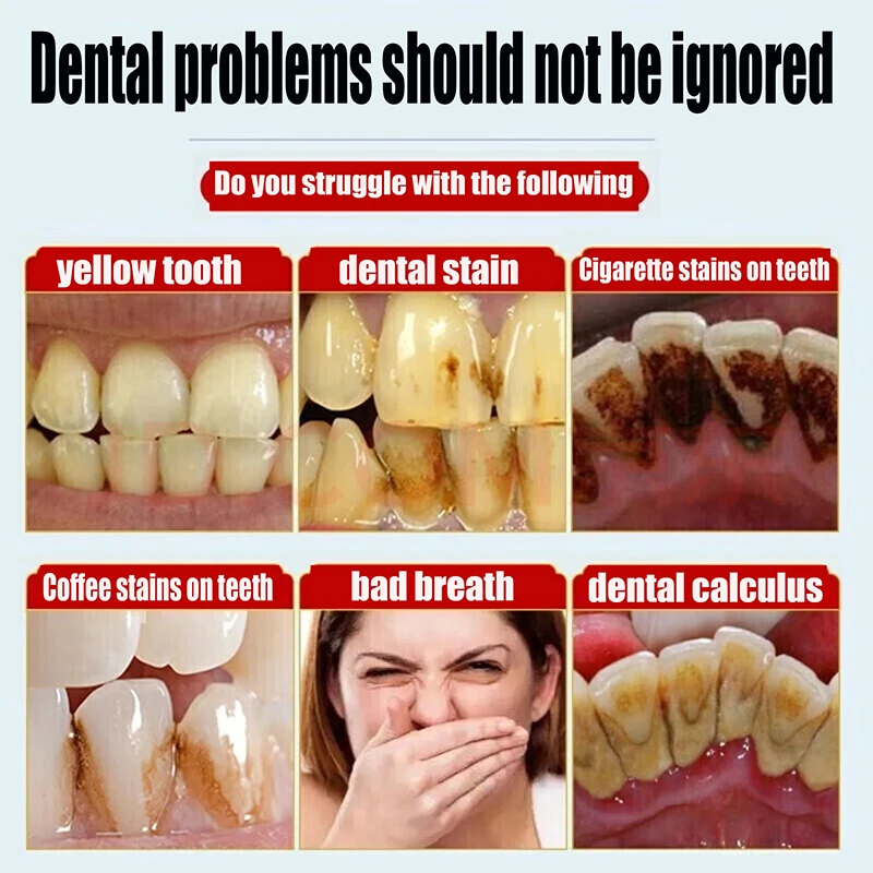 Dissolvant de calcul dentaire, élimine les dents jaunes, élimine les odeurs de bouche, prévention de la mauvaise haleine, parodontite, soins nettoyants, dentifrice