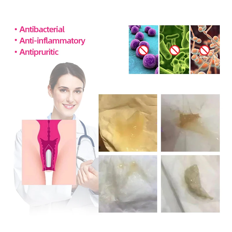 Womb Fibroids Vaginale Detox Vaginal Supository Melts Vagina Tighten Nursing Medical Gynecology Vaginitis Treatment Care