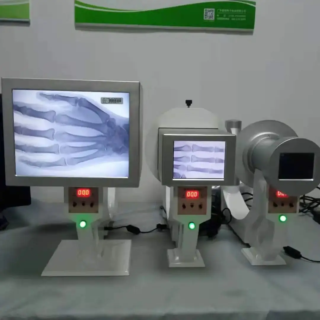 Equipo Médico de escaneo Digital portátil, máquina de rayos X