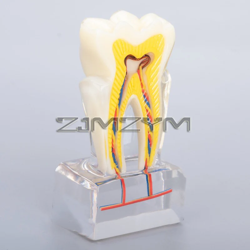 Dental Tooth Anatomy Model With Nerve Vessels Anatomical Cross Section Molar Model Endodontics Root Canal Demonstration Model