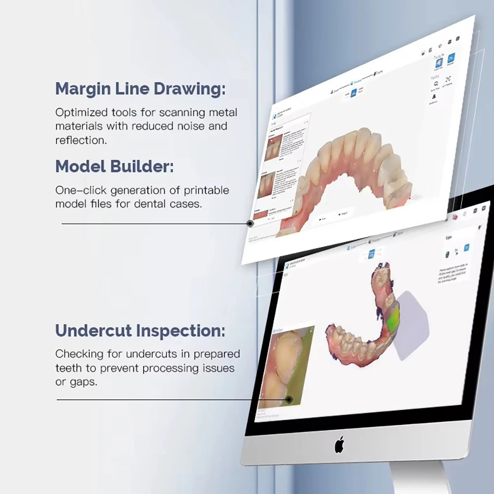 Scanner dentaire 3D, Instrument d'empreintes digitales, affichage en temps réel, Transmission d'image, outils de dentiste