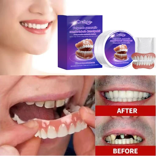 Kit de prothèses dentaires en silicone souple, ajustement confortable, maintien sûr, aspect réaliste, plaques dentaires supérieures et inférieures, remplacement de prothèses dentaires