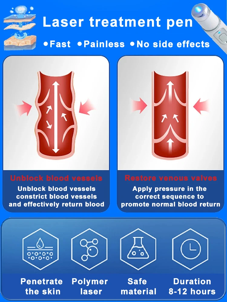 Stylo à lumière bleue le plus vendu pour éliminer les varices