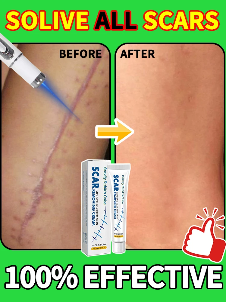 

Laser treatment for body scars, fading it from years past