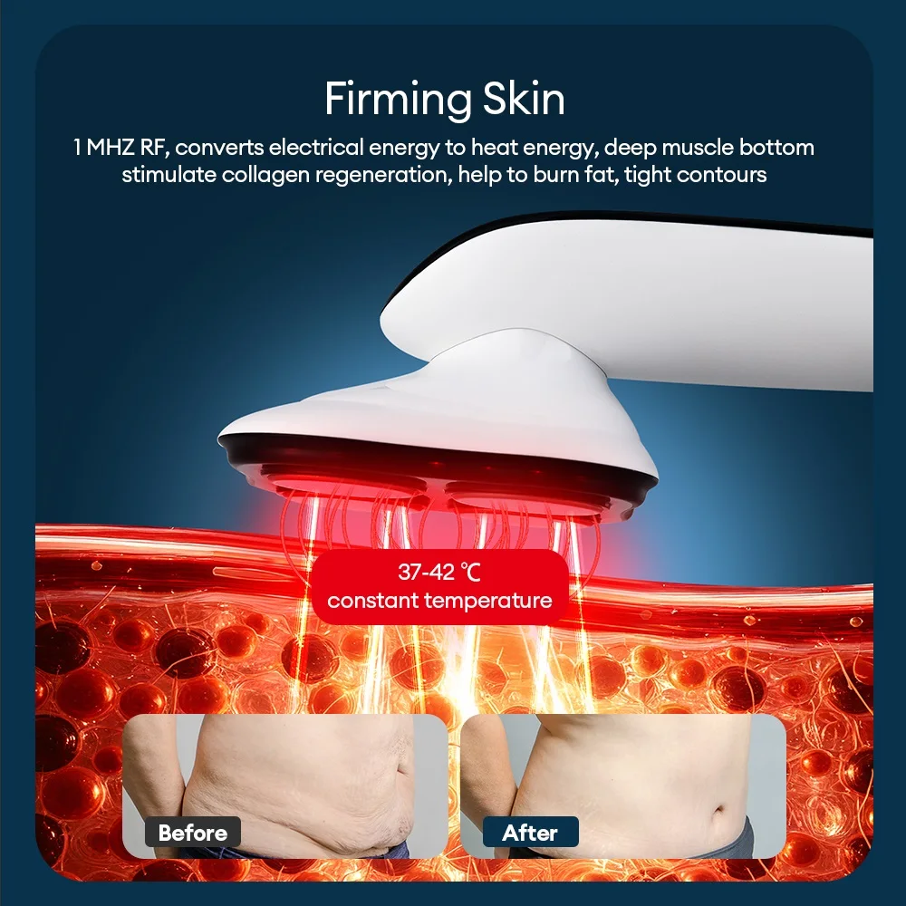 Wireless Body Slimming Massager EMS Microcurrent Abdomen Massage Machine Facial Lifting Skin Firming Back Arms Leg Beauty Device