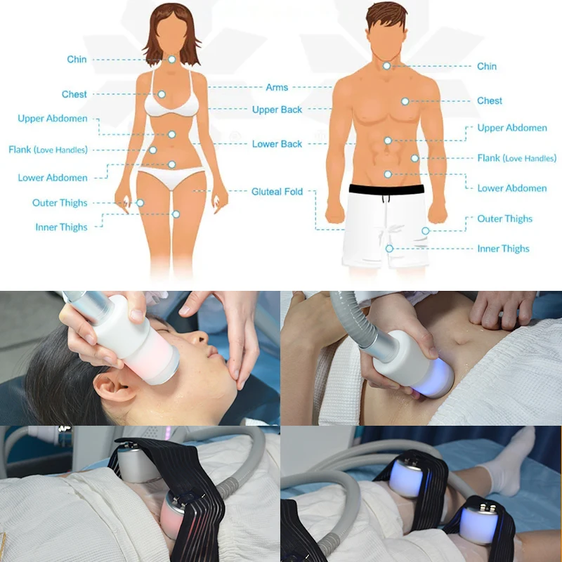 Cryoskin & Thermal & T Shock System Body sculpting Fats Freezing Slimming Machine Weight Loss