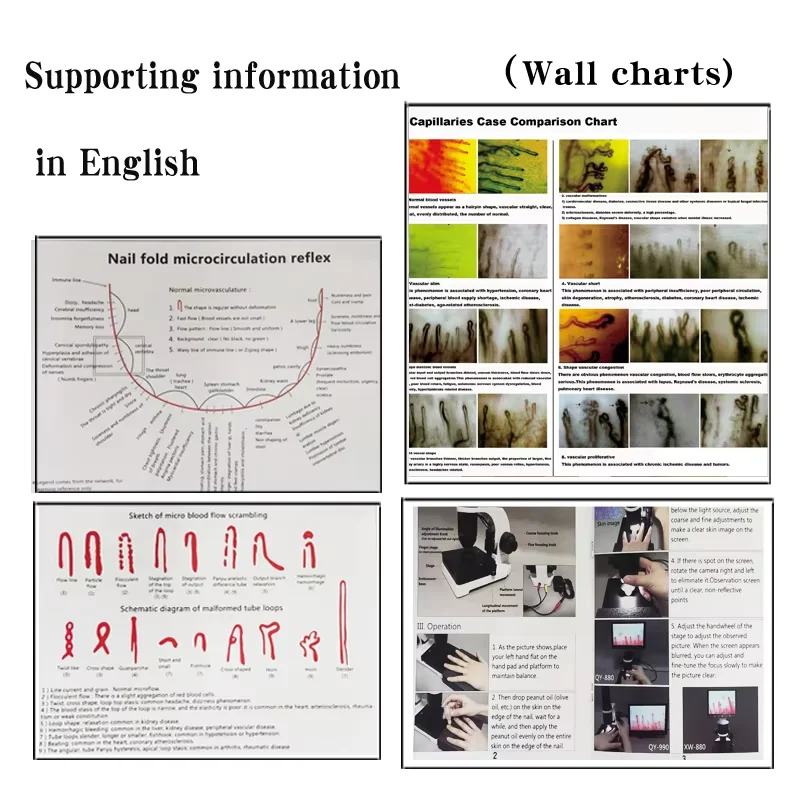 生物学実験室用爪溝微小循環検査機/分析顕微鏡