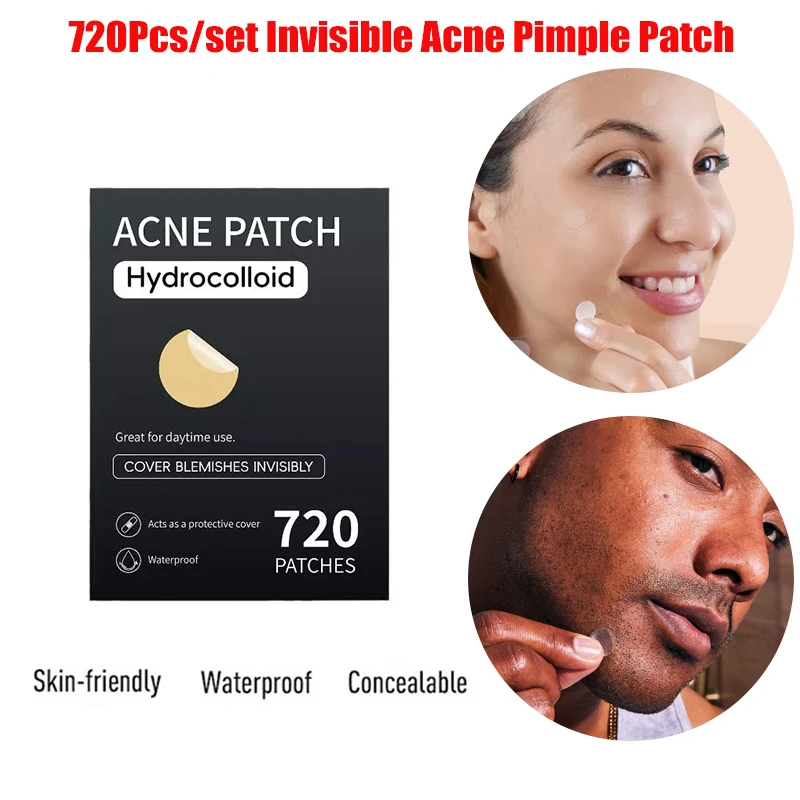 720 pçs/set invisível acne espinha remendos profissional rosto cuidados com a pele reparação acne cura absorvente ponto adesivos para homens