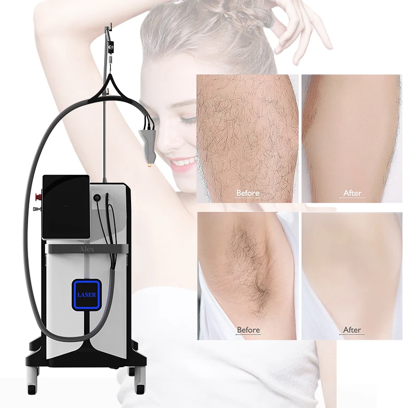 Keylaser Hot Selling Alexandrite Laser 755nm 1064nm Long Pulse Air Cooling Face Whole Body Hair Removal Machine