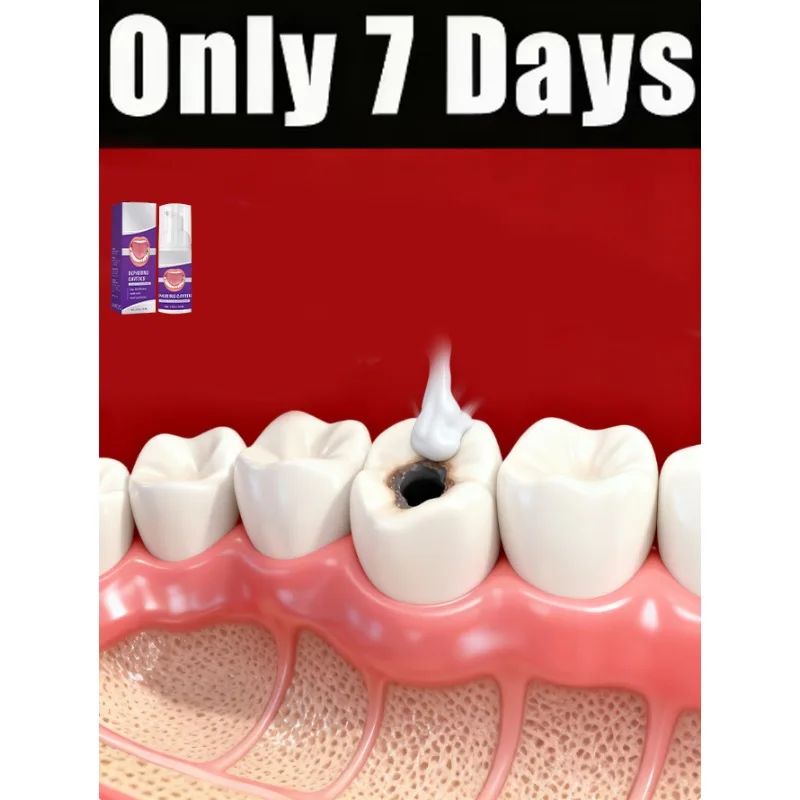 

Модернизированный зуб 3-го поколения восстановление корня зуба рвлют очищает бактерии полости рта.