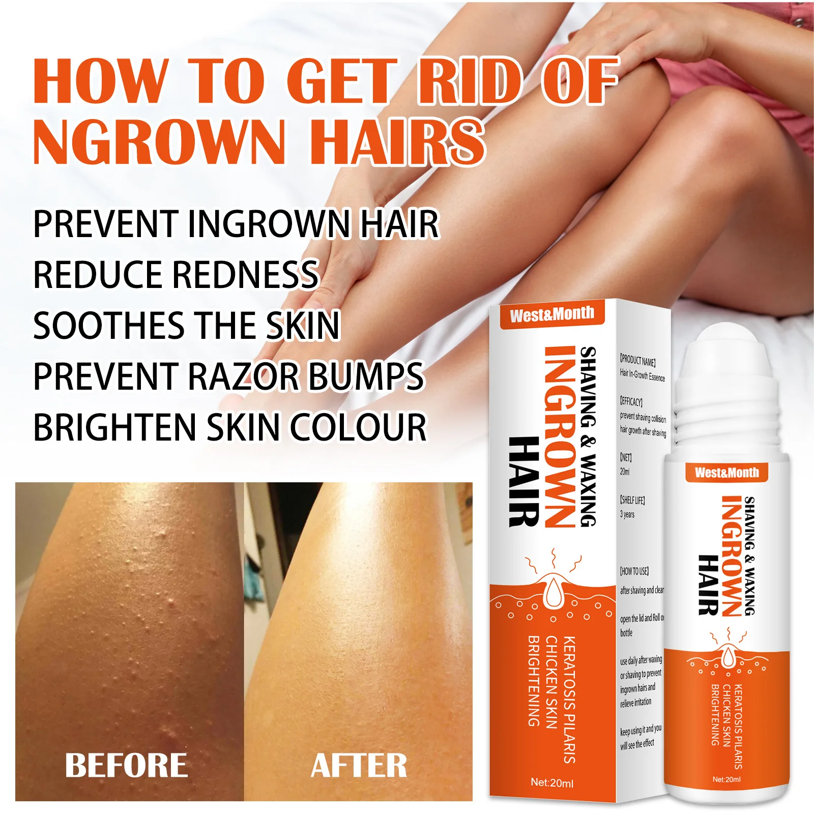 Ingrown Hairs Treatment Serum, Dark Spot Reduction