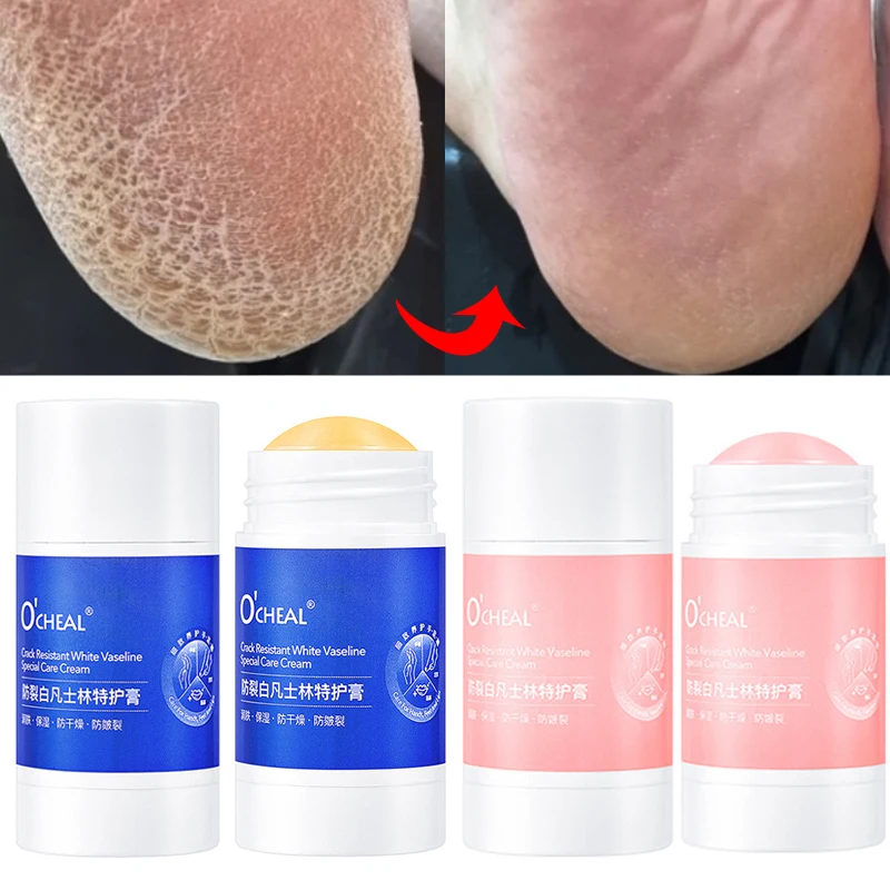 40g Anti Crack Cream Lasting Moisturizing Anti Freezing Hand Foot Care Cream Removal Dead Skin Exfoliantes Beauty Repair Product