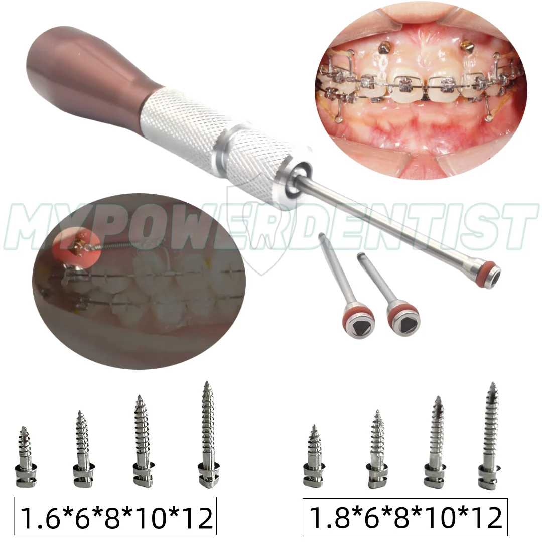 Dental TAS Mini Screw Anchorage Screws Micro Orthodontic 316LVM Implants Screw Driver 8 Size