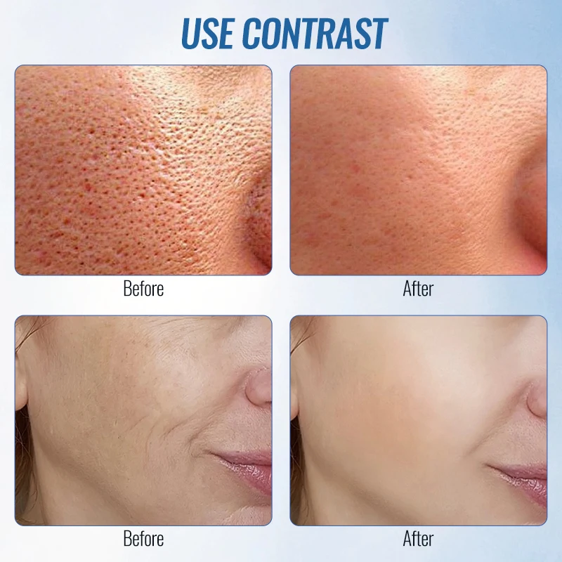 

Alternating Hot & Cold Skin Care Device Soothe and Calm the Skin, Reducing Redness Makes Skin Firmer Direct Attack On the Skin