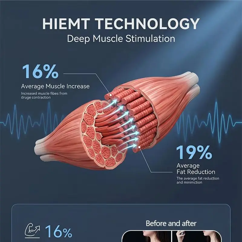 Non-invasive Body Sculpting Machine Electromagnetic Muscle Training Fat Reduction Cellulite Removal For Chain Beauty Spa Aesthet