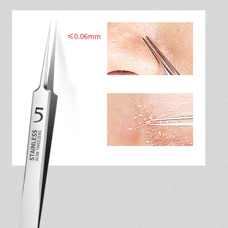 8/7/5/4 pezzi in acciaio inossidabile strumenti per la rimozione dei punti neri del viso set pinzette per punti neri bellezza rimozione dei punti neri strumento per l'ago dell'acne