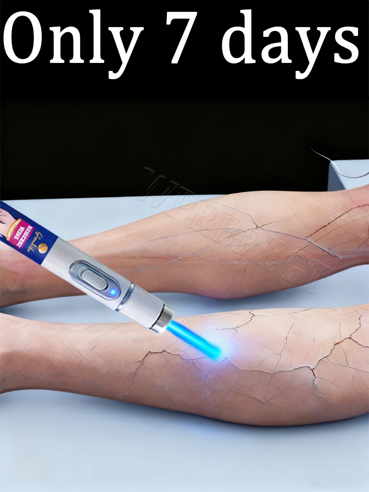 

Расблокирующий венерующий поток крови