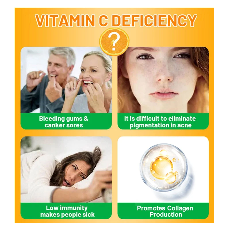 Vitamine C - 1000 mg, 120 capsules, système immunitaire et rehausseur de collagène, vitamine C absorbable 402 soluble dans les graisses, vitamine pour la peau