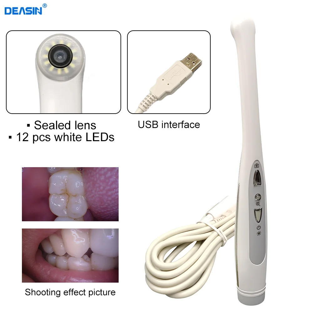 High quality 1080P USB Wired Intraoral Camera Digital Viewer Dental Endoscope Camera Real-time Intra Oral Camera Dentistry Tooth