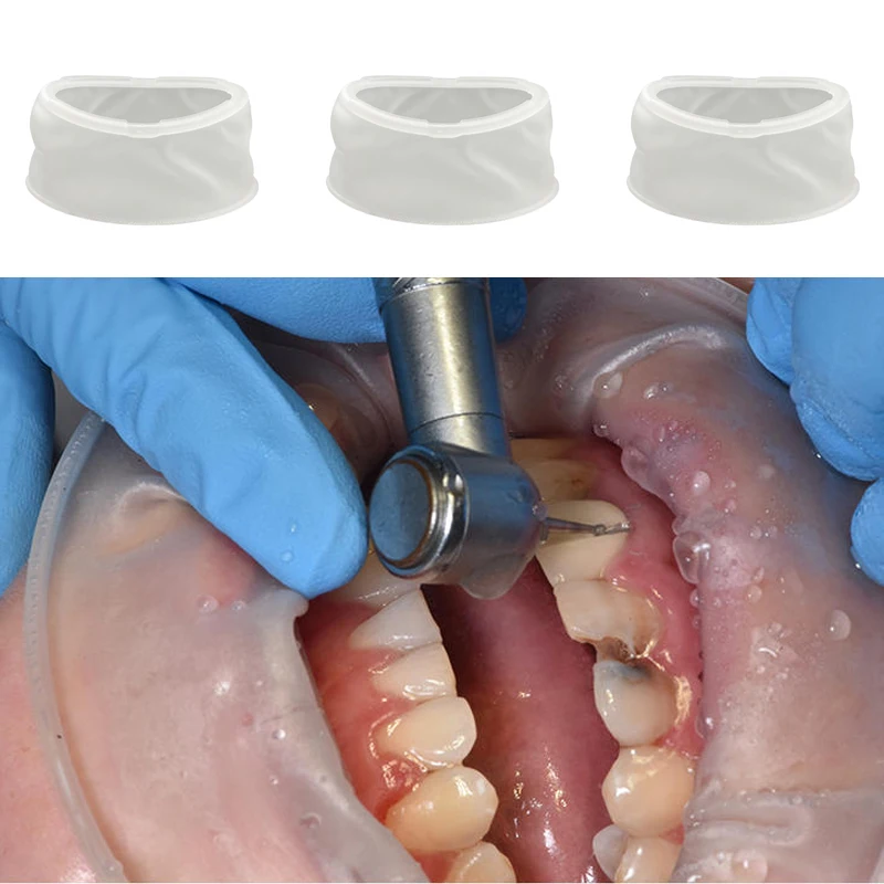 5/10/20Pc Dental Rubber Mouth Opener Cheek Retractors Orthodontic Oral Lip Cheek Retractor Non-Latex O Shape Expander Dentistry