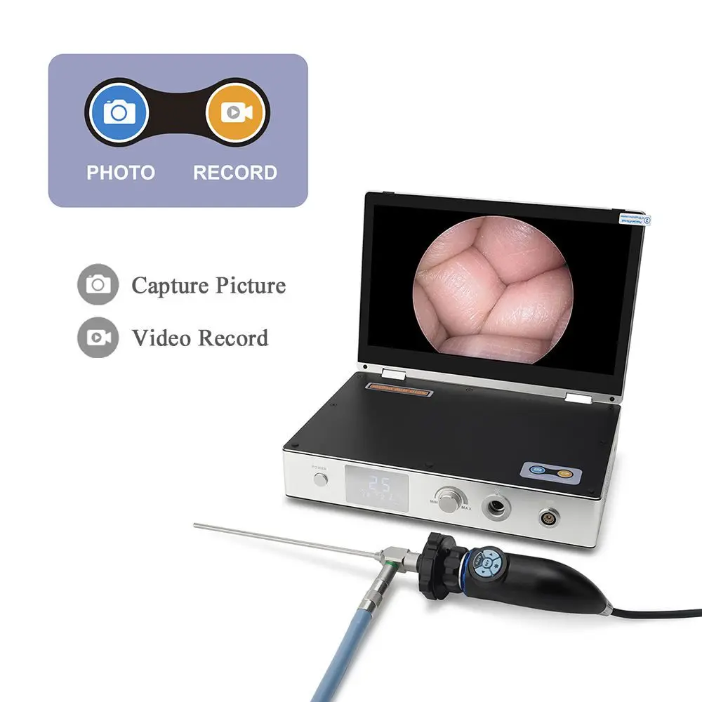 4 in 1 Medical Portable Endoscope Camera System Full HD 1080P with Recorder Endoscope Camera ENT Nasal Veterinary Surgery 11.6