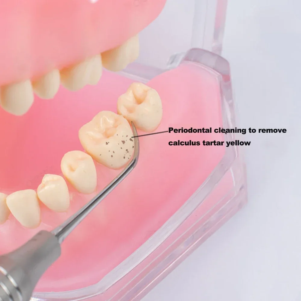 

Набор из 4-х стоматологических инструментов для чистки зубов: скалеры из нержавеющей стали для ухода за полостью рта