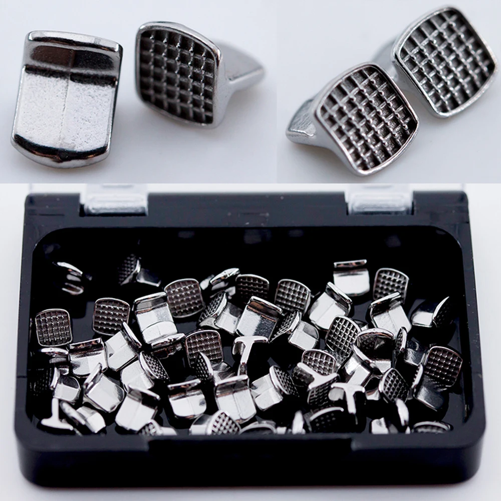 Рисунок 3 - стоматологическая ортодонтия