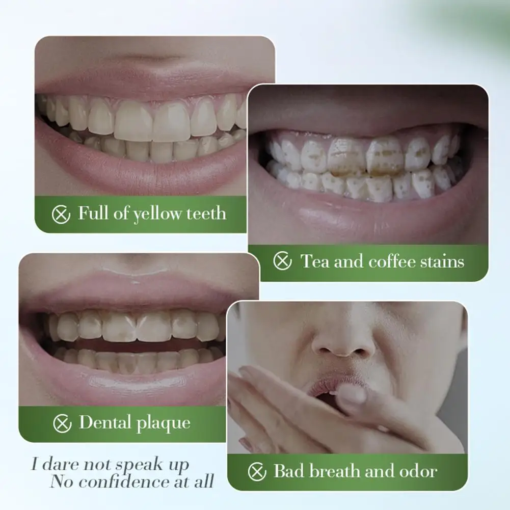    SADOER 3 قطعة نفس مشرق الطازج إزالة البقع تنظيف الأسنان إزالة سيئة تبييض معجون الأسنان معجون الأسنان المنعش