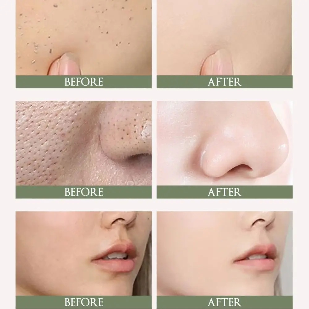 Collagen Exfoliating Gel Cream Gentle And Non-irritating Moisturizing Lady Face Cream Exfoliating Blackheads Gel Skin Care