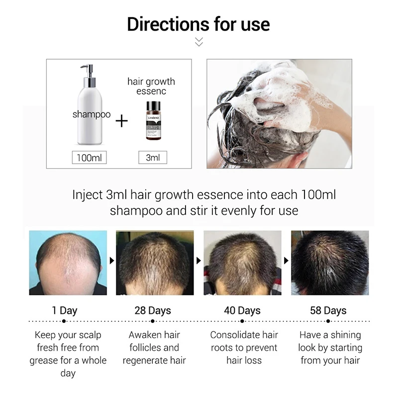 LANBENA Fast Powerful Hair Growth Essential Oil Liquid Treatment Essence Preventing Hair Loss Hair Care Products 20ml