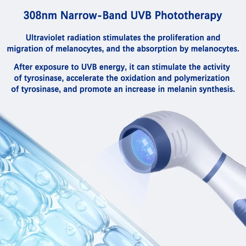 

308nm Household Ultraviolet Phototherapy Instrument, Vitiligo Treatment, UVB Lamp Laser for Therapy, Psoriasis, Skin Disease