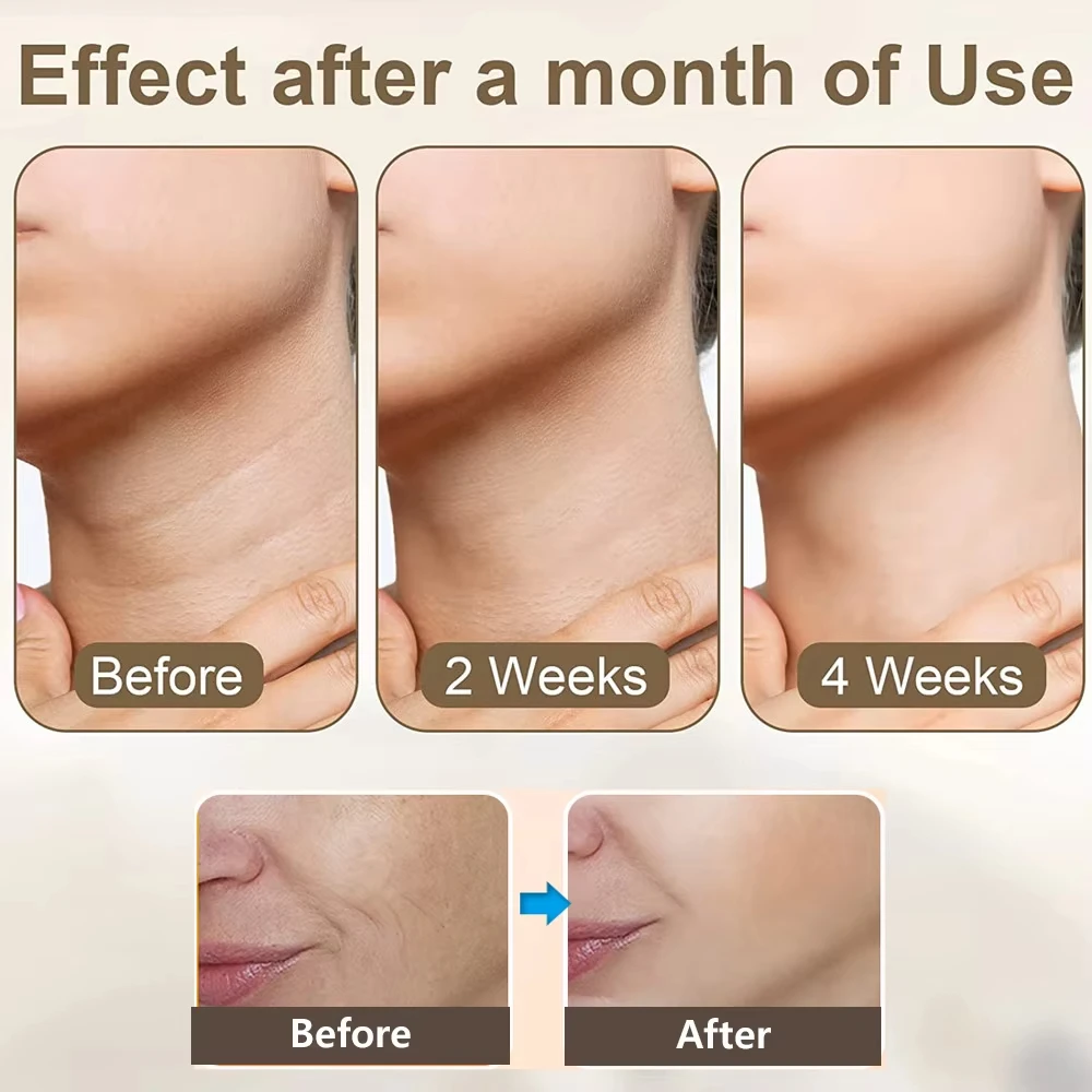 Masajeador de estiramiento Facial para cuello, máquina de estiramiento Facial antienvejecimiento, estiramiento de la piel, antiarrugas, removedor de doble mentón