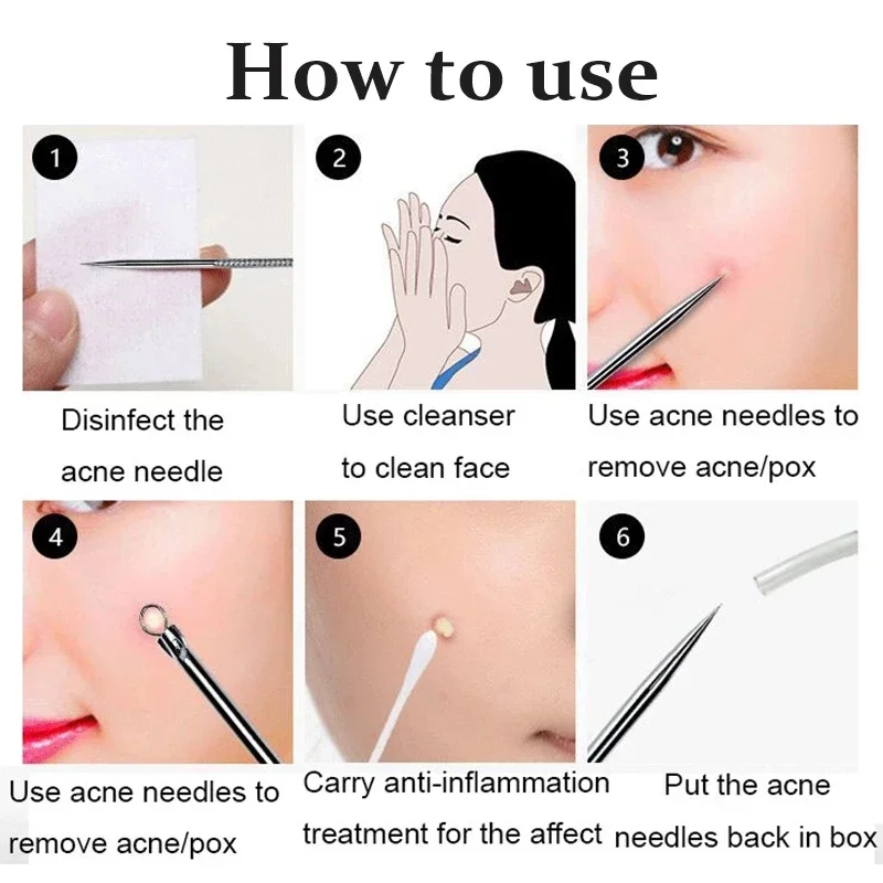الشظية/الذهب البثرة Comedone حب الشباب بثرة Belmish النازع مزيل الرؤوس السوداء أداة نظيفة ملعقة لأداة العناية بالوجه 1 صندوق 4 قطعة #3
