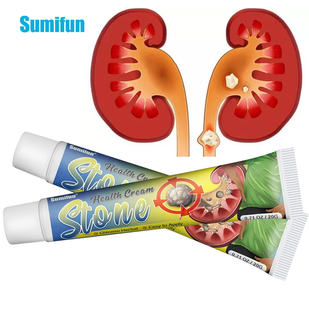 

Sumifun 20g Kidney Stones Removal Cream Treat Gallstones Renal Calculus Medicinal Ointment Urolithiasis Pain Relief Plaster