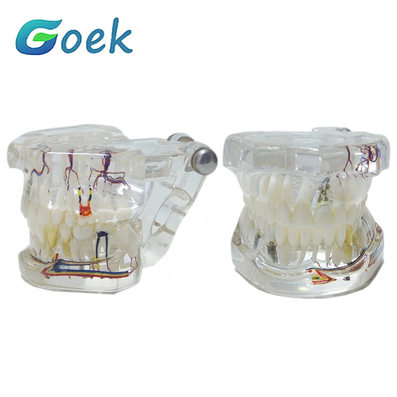 Dental Teaching Model Restoration With Implant Pathological Model With Nerve C15-01 Display Planting Bridge Dentist Tool