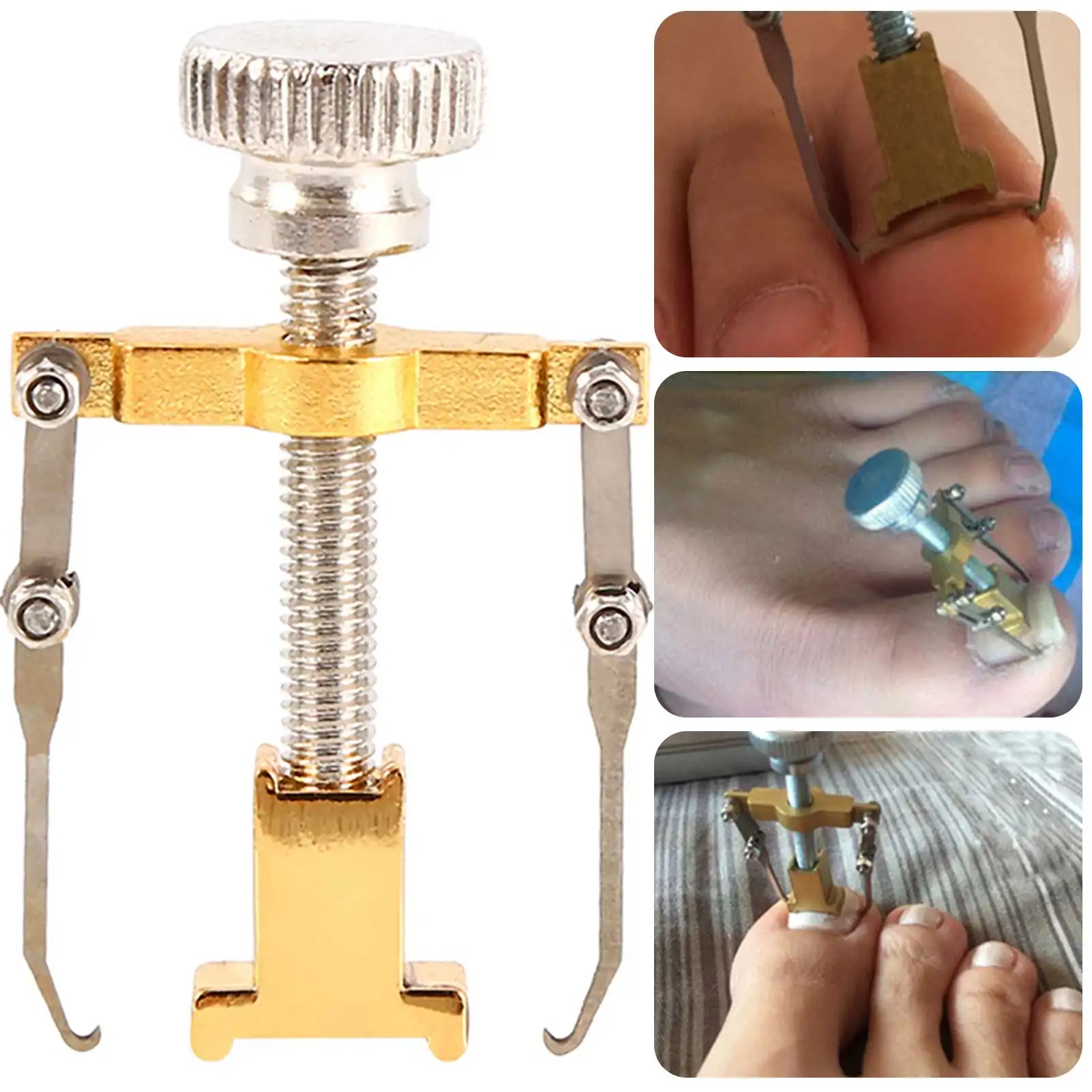 Recuperador de unhas encravadas correção de unhas pedicure fixador portátil corretor de joanete de unhas metal ferramenta de cuidados com os pés