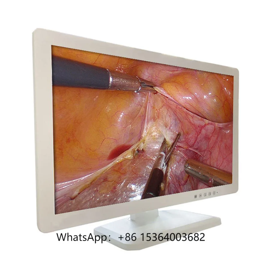 

27'' Full HD High Definition LCD Medical Endoscopy Monitor Display for Endoscope Surgical Use