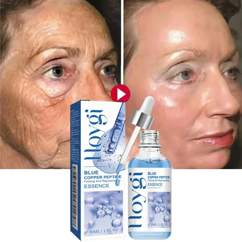 Suero eliminador de arrugas con péptido de cobre azul, reafirmante instantáneo, antienvejecimiento, decoloración de líneas finas, blanqueamiento, productos coreanos para el cuidado de la piel
